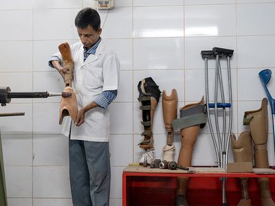 Artificial limbs change lives: Here’s how we can scale them up in low-income countries - Header Image